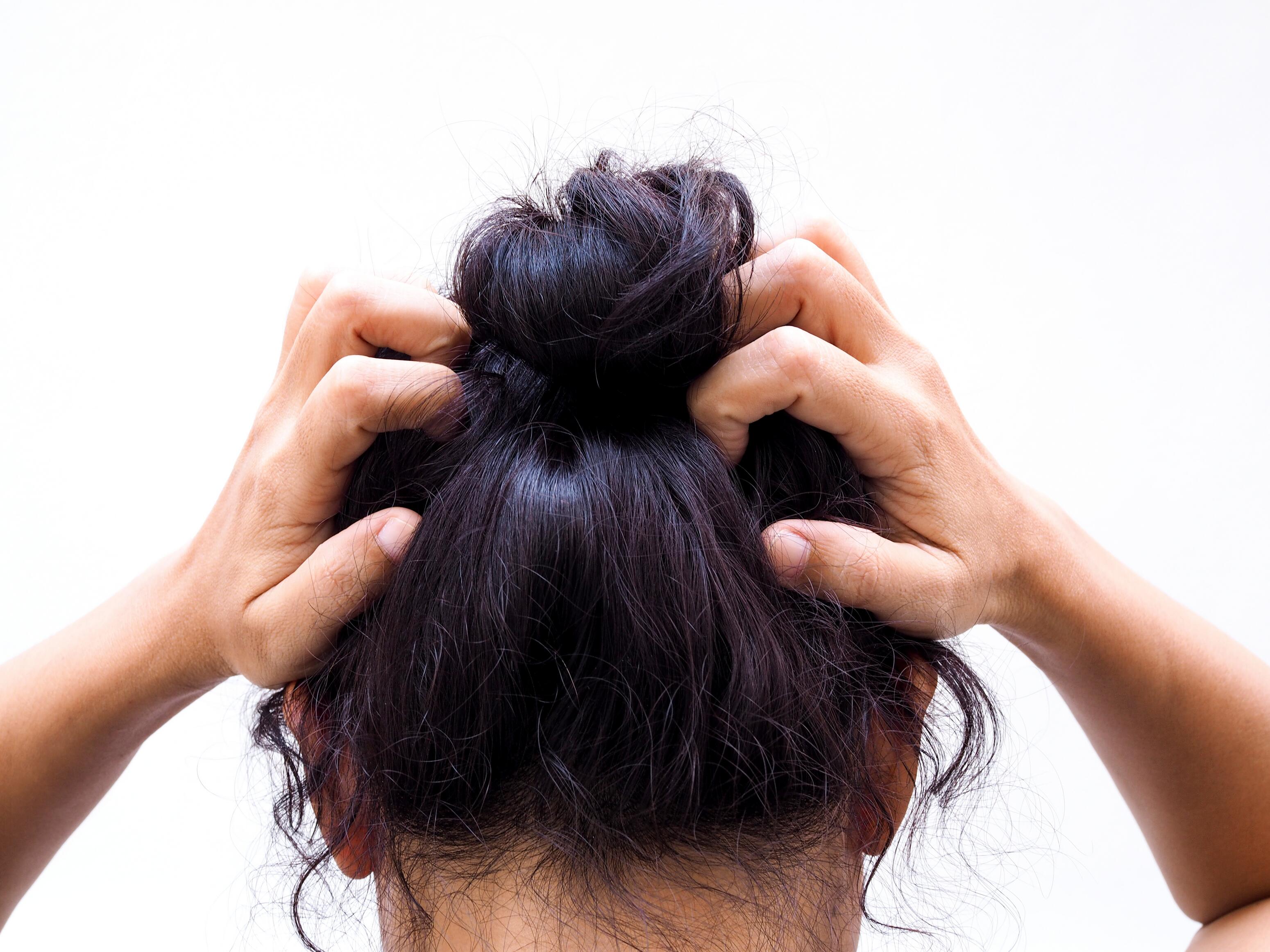 Causes de la chute de cheveux chez la femme